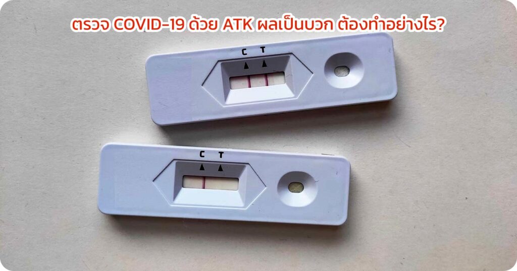 ตรวจ COVID-19 ด้วย ATK ผลเป็นบวก ต้องทำอย่างไร?